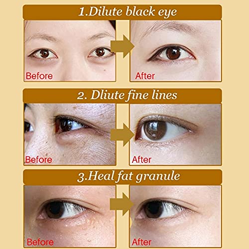 Innicare 20 pcs קריסטל קולגן זהב מסיכת עיניים אנטי-אייג'ינג עיגולים כהים טלאי יופי אקנה לטיפול בעור העין קוסמטיקה קוריאנית